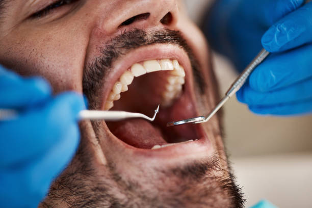 Best Wisdom Tooth Removal  in Weimar, TX